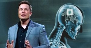 Neuralink của Elon Musk phát hiện sự cố sau ca cấy chip vào não người